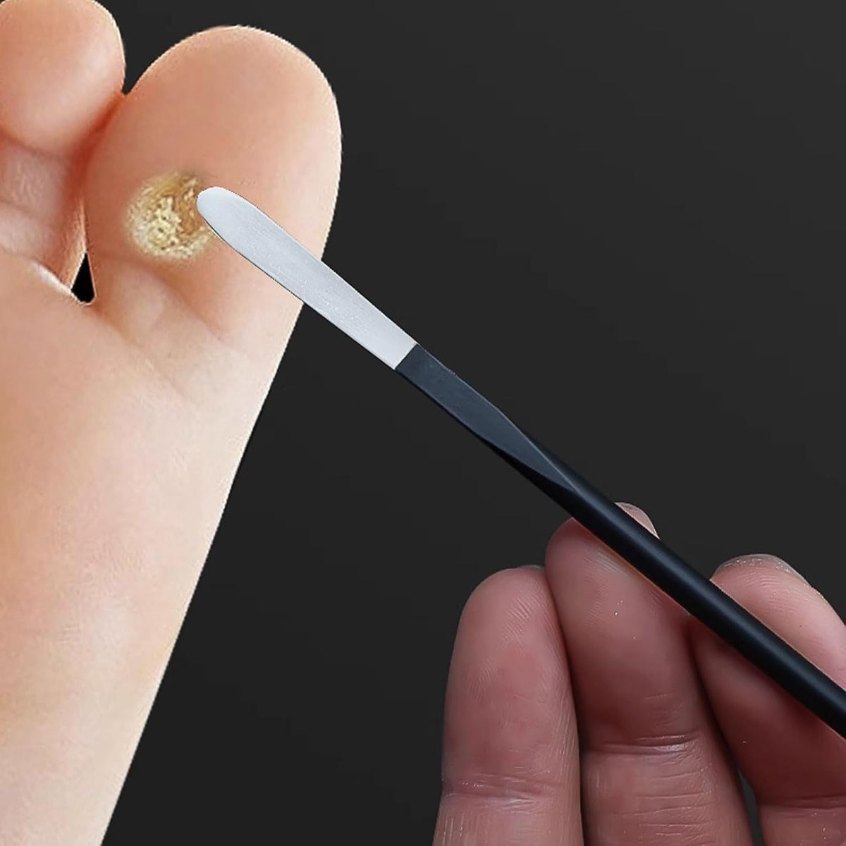 Corn Remover Tool, Pedicure Tools for Feet, Stainless Steel Pedicure Knife for Toes with Non Slip Handle for Peels
