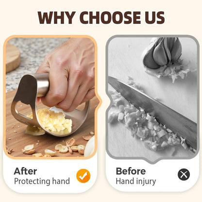 Stainless Steel Garlic Press, 2025 Upgraded Garlic Press Stainless Steel, Garlic Press Rocker, Portable Manual Garlic Crusher, Stainless Steel Garlic Mincer tool with Peeler and Brush (1)