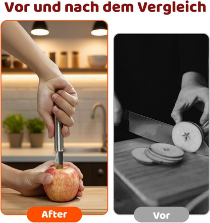 Apple Corer Remover Set, 5-Piece Stainless Steel Fruit Corer Tools with Ergonomic Handles, Pineapple Cutter Slicer and Corers for Kitchen, Baking, Healthy Meal Prep, 20 Cm Length